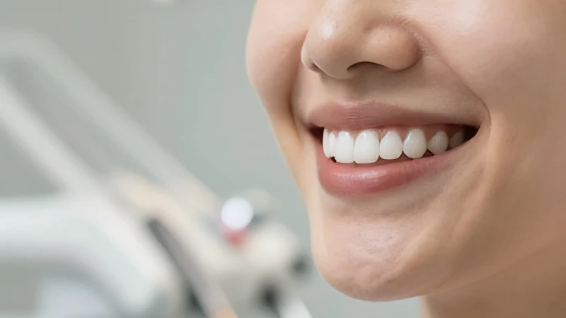 Diş Beyazlatma Bleaching Seans Ücretleri ve Maliyeti